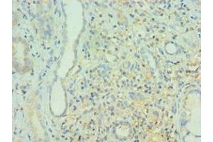 Immunohistochemistry of paraffin-embedded human kidney tissue using ABIN7160382 at dilution of 1:100 (BIN1 anticorps  (AA 414-593))