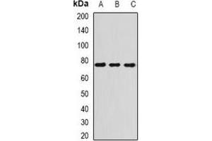Western blot analysis of ATR expression in H460 (A), Hela (B), mouse spleen (C) whole cell lysates.