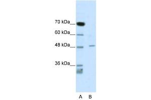 CACNB4 antibody used at 1 ug/ml to detect target protein. (CACNB4 anticorps  (C-Term))