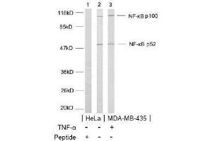 Image no. 2 for anti-Nuclear Factor of kappa Light Polypeptide Gene Enhancer in B-Cells 2 (NFKB2) (AA 868-872) antibody (ABIN197120) (NFKB2 anticorps  (AA 868-872))