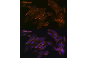 anti-DEAD (Asp-Glu-Ala-Asp) Box Polypeptide 6 (DDX6) antibody
