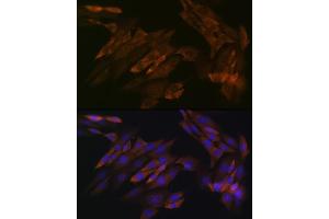 Immunofluorescence analysis of NIH-3T3 cells using DDX6 Rabbit mAb (ABIN7266703) at dilution of 1:100 (40x lens).