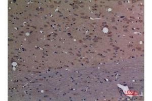 Immunohistochemistry (IHC) analysis of paraffin-embedded Rat Brain, antibody was diluted at 1:100.