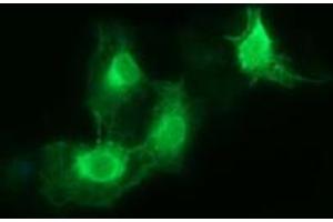 Image no. 3 for anti-Fc Fragment of IgG, High Affinity Ia, Receptor (CD64) (FCGR1A) antibody (ABIN1497349) (FCGR1A anticorps)