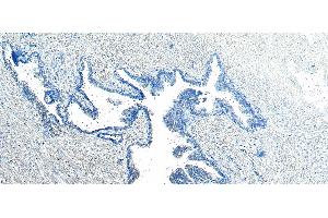 ABIN185182 Negative Control showing staining of paraffin embedded Human Prostate, with no primary antibody.