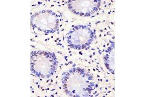 C staining PELP1 in human colon tissue sections by Immunohistochemistry (IHC-P - paraformaldehyde-fixed, paraffin-embedded sections). (PELP1 anticorps  (AA 744-771))
