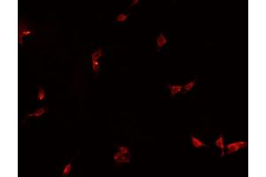 ABIN6266867 staining HeLa  cells by IF/ICC. (HEXIM1 anticorps)