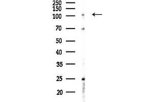 Western blot analysis of lysates from F10-LUC cells(heat-shock 45 min treatment), using ABCF1 Antibody at 1/1000 dilution.