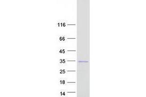 Validation with Western Blot