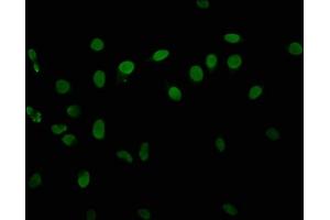 Immunofluorescence staining of Hela cells with ABIN7139629 at 1:10, counter-stained with DAPI. (HIST1H3A anticorps  (H3T6ph))