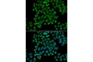 Immunofluorescence analysis of HeLa cells using GRI antibody (ABIN6127964, ABIN6141386, ABIN6141387 and ABIN6218189). (Glutamate Receptor 3 anticorps  (AA 200-490))