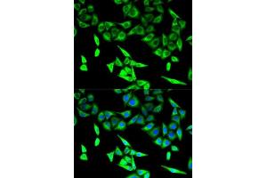 Immunofluorescence analysis of U2OS cells using HADHA antibody.