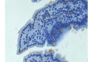 Detection of ANGPT2 in Mouse Intestine Tissue using Polyclonal Antibody to Angiopoietin 2 (ANGPT2)