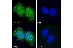 ABIN308459 Immunofluorescence analysis of paraformaldehyde fixed U2OS cells, permeabilized with 0. (AUTS2 anticorps  (C-Term))
