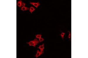 ABIN6266834 staining HeLa by IF/ICC. (DIRAS1 anticorps  (C-Term))