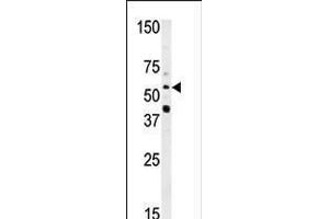 Western blot analysis of anti-NMT2 Pab in HepG2 cell line lysate (35ug/lane)