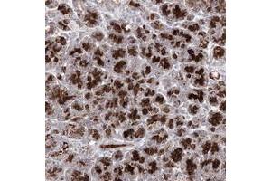 Immunohistochemical staining of human pancreas with C11orf80 polyclonal antibody  shows strong granular cytoplasmic positivity in exocrine glandular cells at 1:10-1:20 dilution. (C11ORF80 anticorps)
