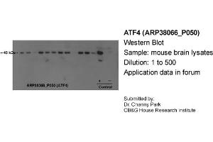 Western Blotting (WB) image for anti-Activating Transcription Factor 4 (Tax-Responsive Enhancer Element B67) (ATF4) (N-Term) antibody (ABIN2780377) (ATF4 anticorps  (N-Term))