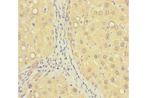 Immunohistochemistry of paraffin-embedded human liver tissue using ABIN7176405 at dilution of 1:100