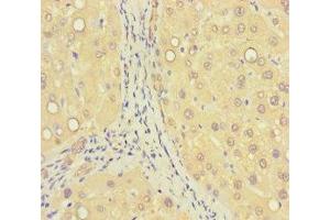 Immunohistochemistry of paraffin-embedded human liver tissue using ABIN7176405 at dilution of 1:100 (ZNF583 anticorps  (AA 1-300))