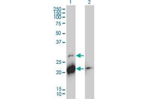Western Blot analysis of BID expression in transfected 293T cell line by BID monoclonal antibody (M01), clone 3F3-1A3.