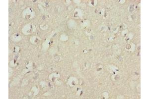 Immunohistochemistry of paraffin-embedded human brain tissue using ABIN7173675 at dilution of 1:100 (TUBB1 anticorps  (AA 270-451))