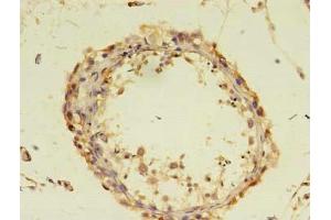 Immunohistochemistry of paraffin-embedded human testis tissue using ABIN7149583 at dilution of 1:100 (DOCK1 anticorps  (AA 1645-2186))