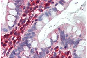 Small intestine, Human: Formalin-Fixed, Paraffin-Embedded (FFPE)