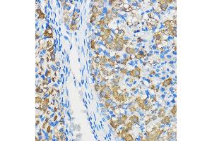 Immunohistochemistry of paraffin-embedded Rat ovary using  antibody (ABIN3020671, ABIN3020672, ABIN1512605 and ABIN6213659) at dilution of 1:50 (40x lens).