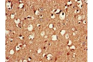Immunohistochemistry of paraffin-embedded human brain tissue using ABIN7150991 at dilution of 1:100 (RNF4 anticorps  (AA 471-724))