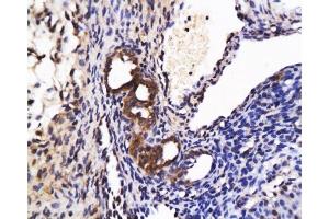 Formalin-fixed and paraffin-embedded : rat ovary tissue labeled with Rabbit Anti-APELIN RECEPTOR Polyclonal Antibody, Unconjugated 1:200 followed by conjugation to the secondary antibody and DAB staining