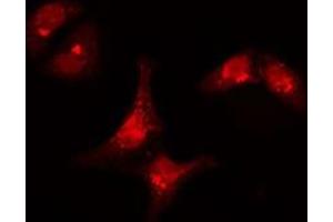 ABIN6277308 staining  Hela cells by IF/ICC. (KRT15 anticorps  (N-Term))