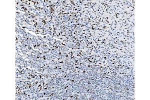 IHC analysis of SAMHD1 using anti-SAMHD1 antibody (ABIN7601515).
