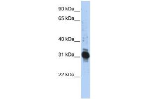 WB Suggested Anti-ZFAND3 Antibody Titration:  0. (ZFAND3 anticorps  (Middle Region))