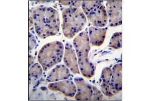Immunohistochemistry analysis in Formalin Fixed, Paraffin Embedded Human stomach tissue stained with RPL23 Antibody (Center) followed by peroxidase conjugation of the secondary antibody and DAB staining.
