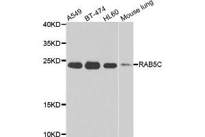 Western blot analysis of extracts of various cell lines, using RAB5C antibody (ABIN5975504) at 1/1000 dilution. (Rab5c anticorps)