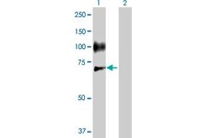 Western Blot analysis of SELE expression in transfected 293T cell line by SELE MaxPab polyclonal antibody. (Selectin E/CD62e anticorps  (AA 1-610))