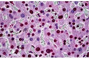 Human Liver: Formalin-Fixed, Paraffin-Embedded (FFPE) (SGK1 anticorps  (AA 1-91))