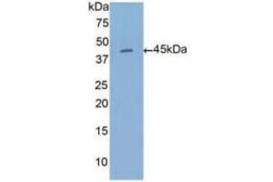 WB of Protein Standard: different control antibodies against Highly purified E.
