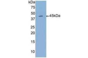 WB of Protein Standard: different control antibodies against Highly purified E. (Annexin a1 Kit ELISA)