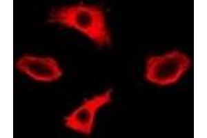 Immunofluorescent analysis of IMPA1 staining in A549 cells.