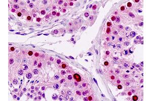 Anti-LSM2 / SnRNP antibody IHC staining of human testis.