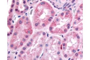 Image no. 4 for anti-Hypoxia Inducible Factor 1, alpha Subunit (Basic Helix-Loop-Helix Transcription Factor) (HIF1A) (AA 432-528) antibody (ABIN363317)