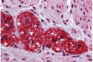 anti-SRY (Sex Determining Region Y)-Box 6 (SOX6) (C-Term) antibody