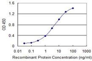 Detection limit for recombinant GST tagged SSTR1 is 0.