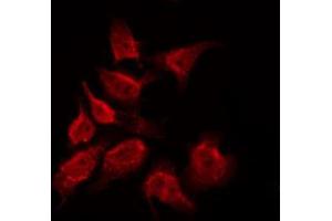 ABIN6269071 staining COS7 by IF/ICC. (ABL1 anticorps)