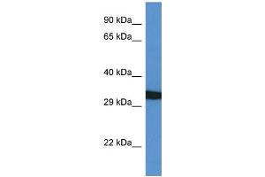 WB Suggested Anti-GFRA4 AntibodyTitration: 1. (GFRA4 anticorps  (C-Term))