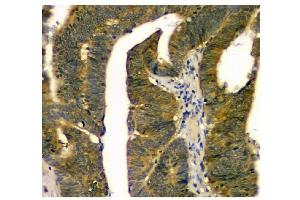 IHC analysis of STUB1 using anti STUB1 antibody (ABIN6719414).