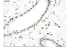Immunohistochemical staining of paraffin-embedded breast tissue using anti-MAP2K4 mouse monoclonal antibody. (MAP2K4 anticorps)