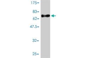 Western Blot detection against Immunogen (67. (MEIS2 anticorps  (AA 1-381))